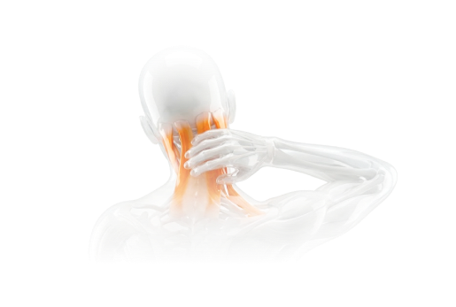 교통사고 후유증